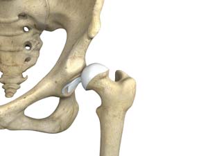 Hip Adductor Injuries
